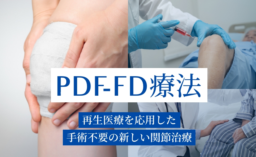 PDF-FD療法 再生医療を応用した手術不要の新しい関節治療